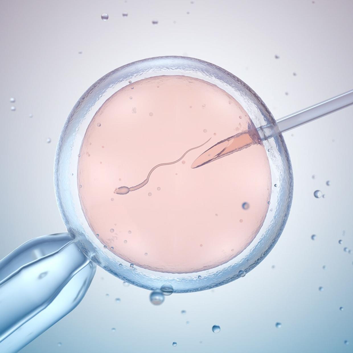 IVF postupak